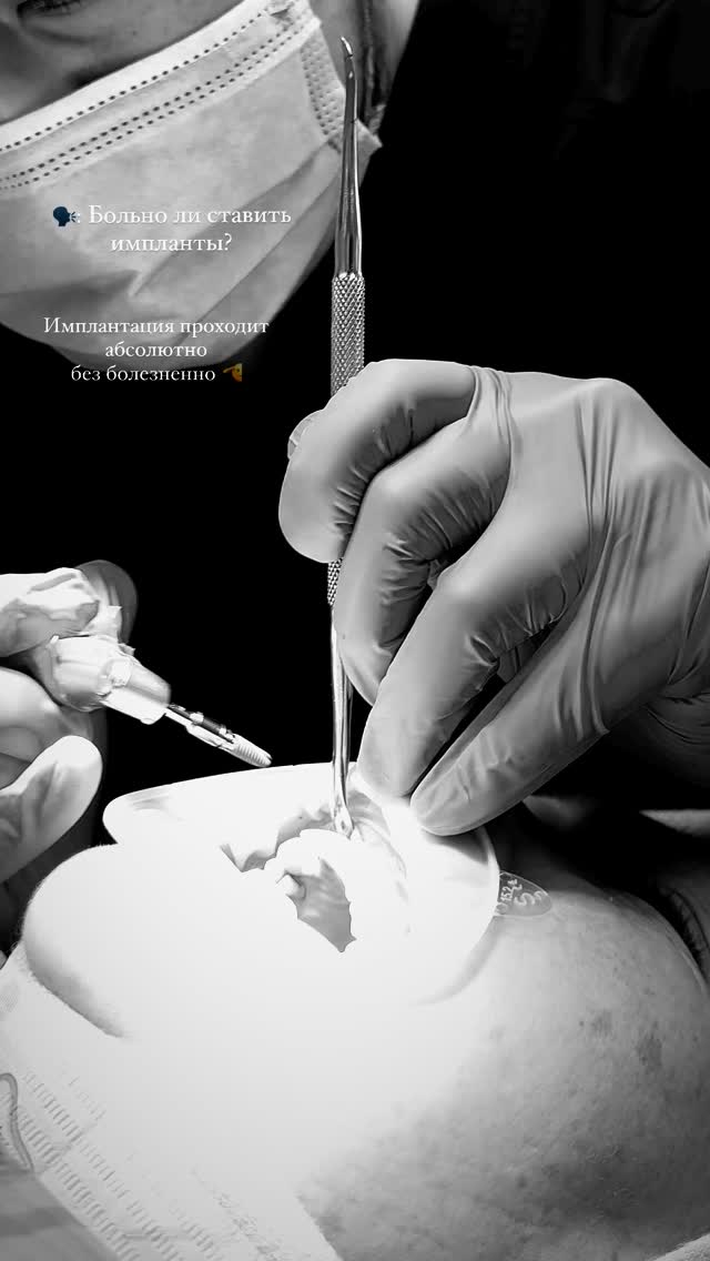 Имплантация