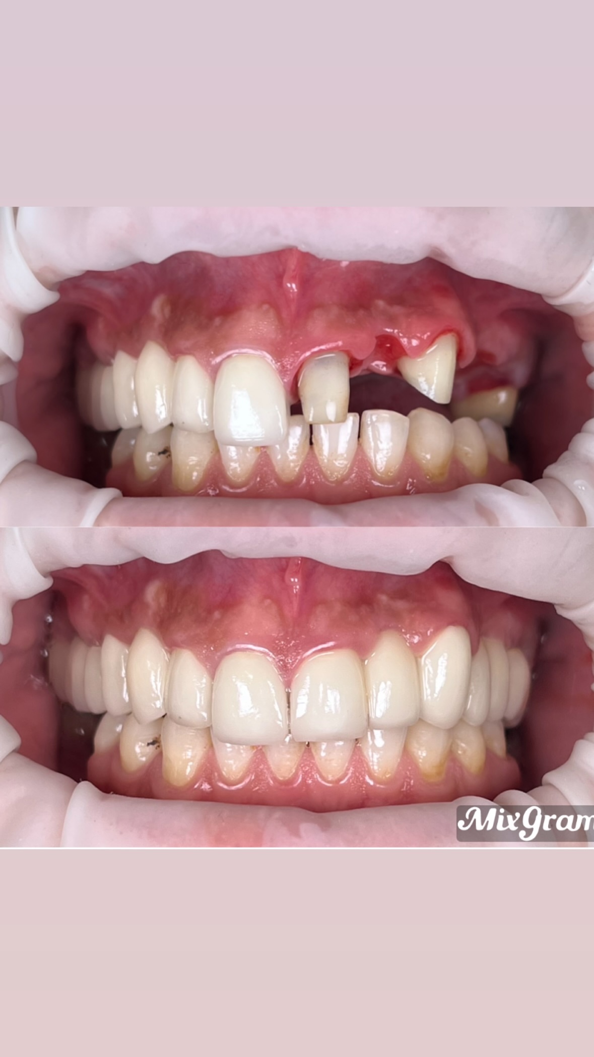 Результат до/после