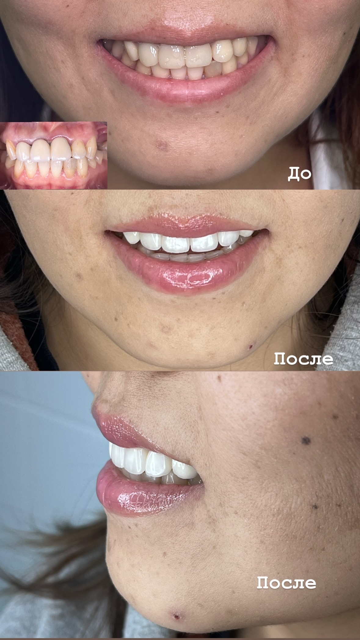 До/после — результат 3