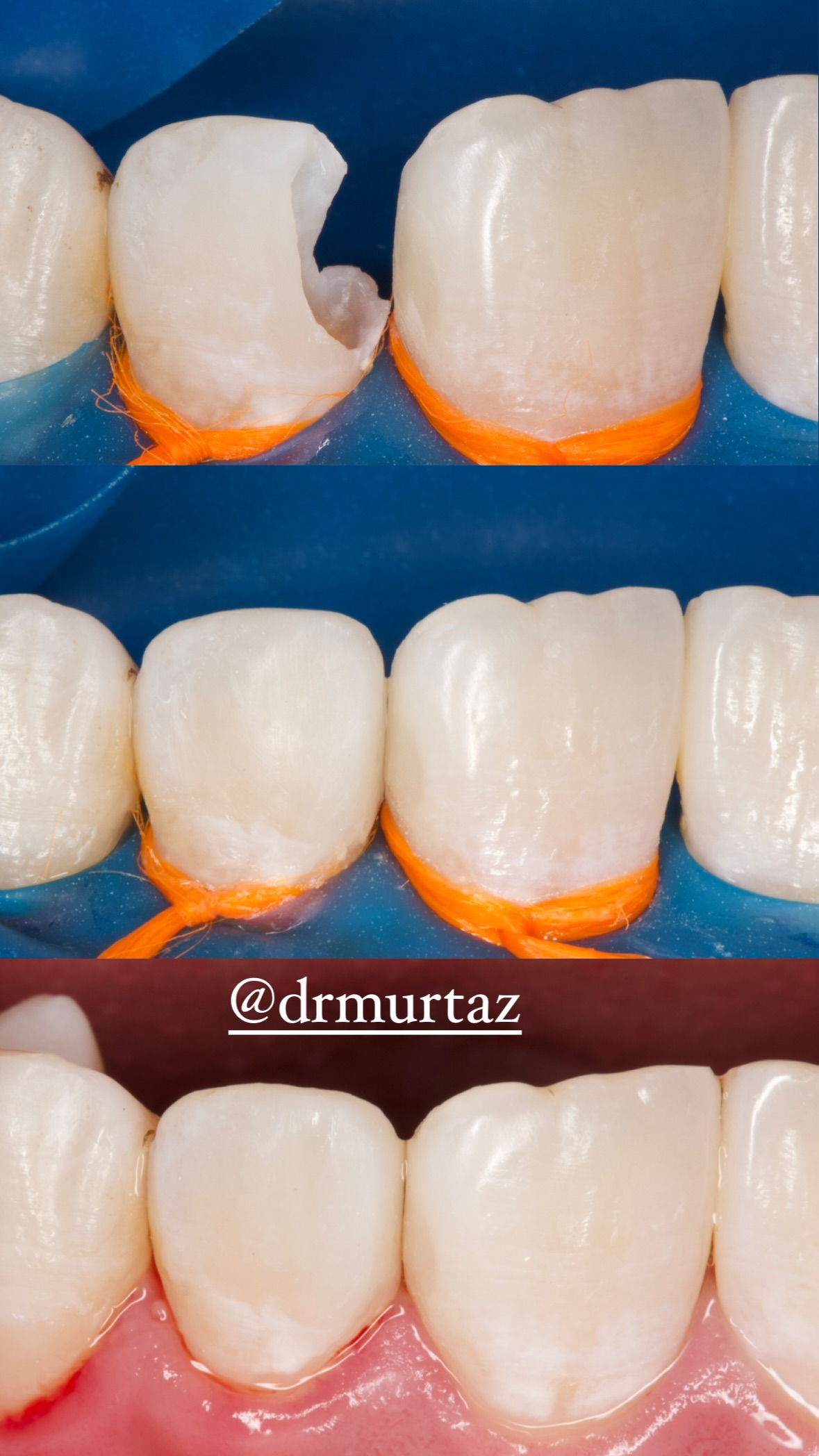 До/после — результат 4