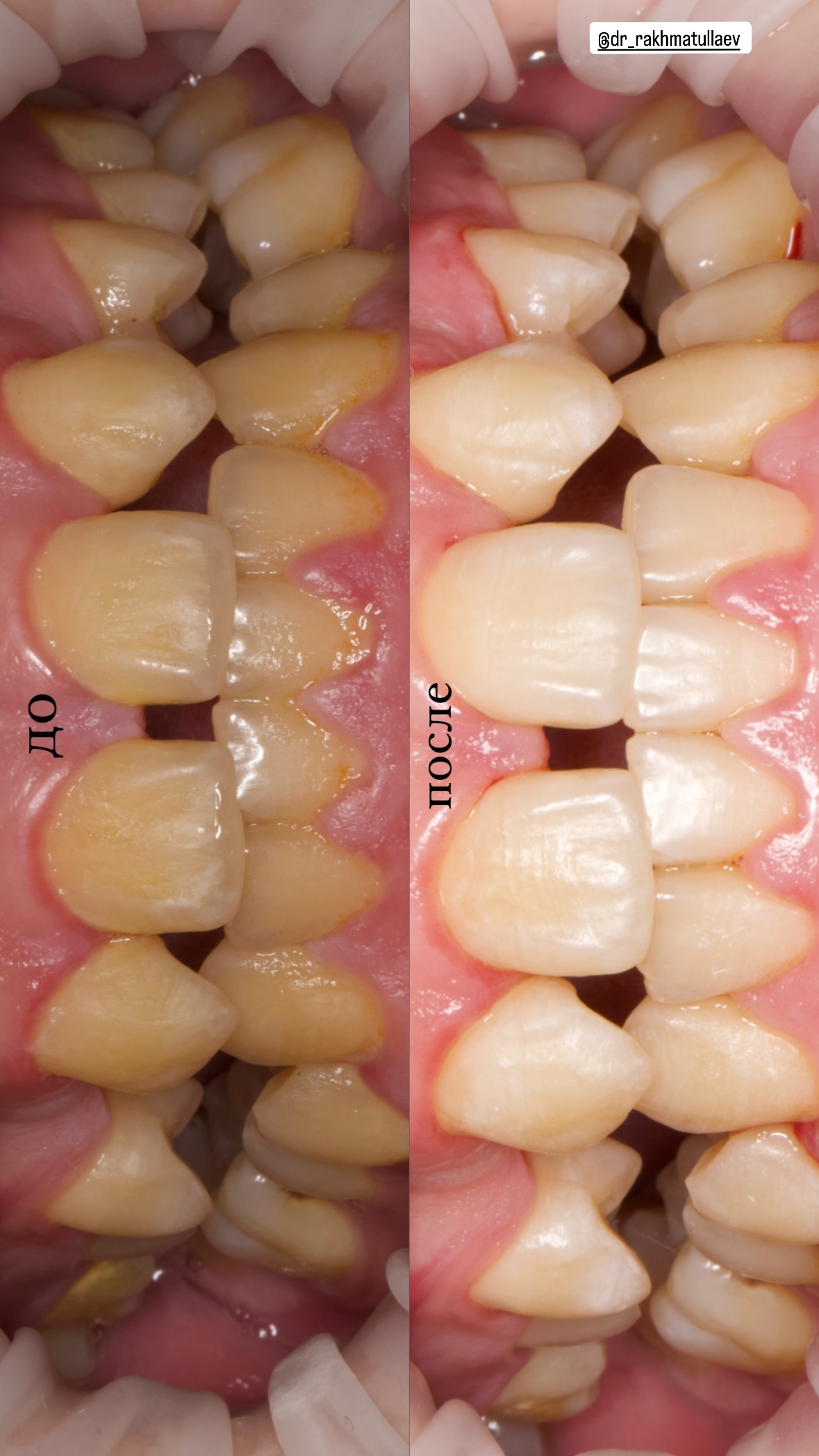 До/после — результат 5
