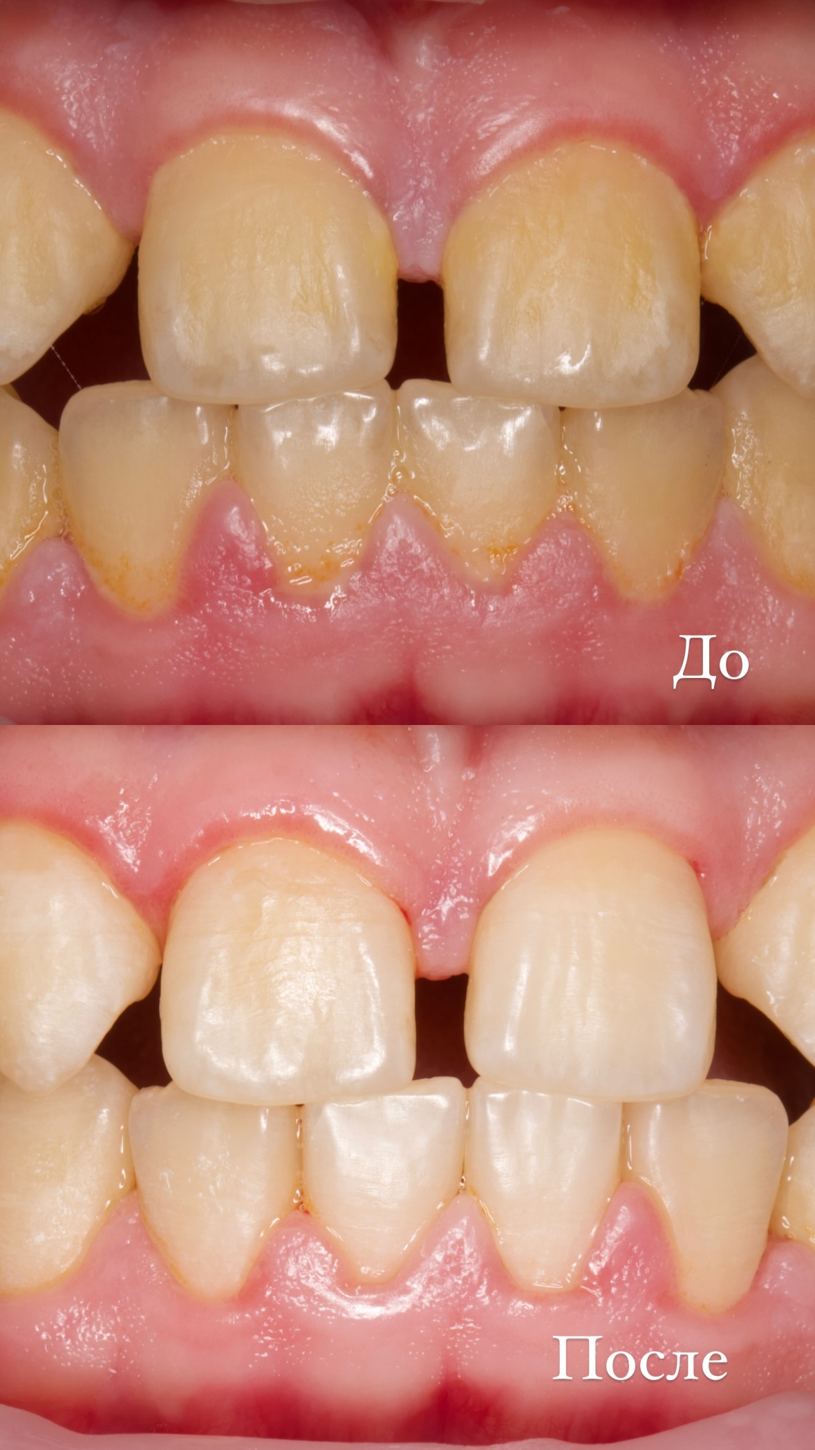 До/после — результат 6